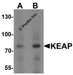 <strong>Figure 1 Western Blot Validation of KEAP1 in Human Lung </strong><br>
Loading: 15 &#956;g of lysates per lane.
Antibodies: KEAP1 7045 (A: 1 &#956;g/mL; B: 2 &#956;g/mL), 1h incubation at RT in 5% NFDM/TBST.
Secondary: Goat anti-rabbit IgG HRP conj