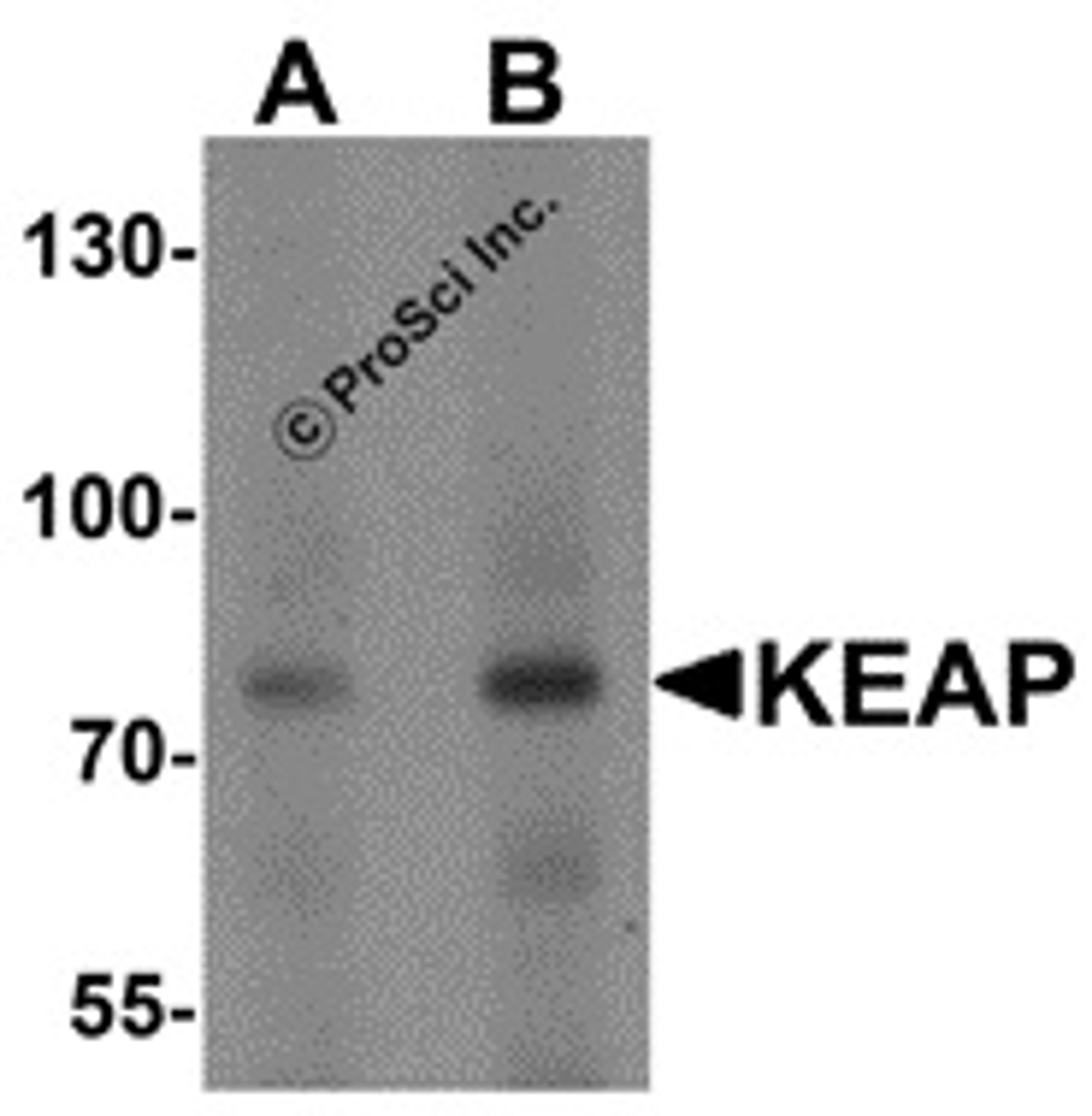 <strong>Figure 1 Western Blot Validation of KEAP1 in Human Lung </strong><br>
Loading: 15 &#956;g of lysates per lane.
Antibodies: KEAP1 7045 (A: 1 &#956;g/mL; B: 2 &#956;g/mL), 1h incubation at RT in 5% NFDM/TBST.
Secondary: Goat anti-rabbit IgG HRP conj