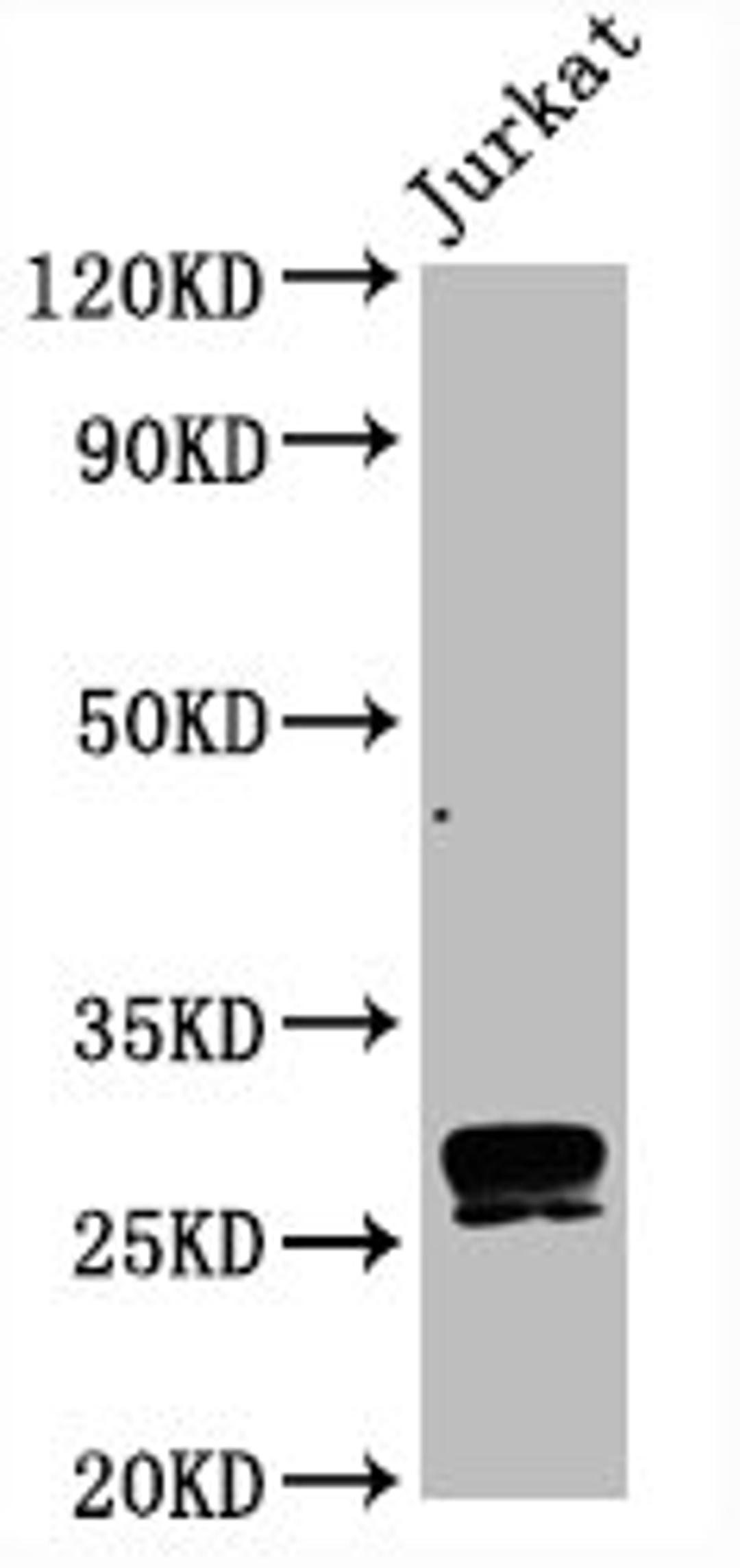 Western Blot. Positive WB detected in Jurkat whole cell lysate. All lanes CD99 antibody at 0.8μg/ml. Secondary. Goat polyclonal to rabbit IgG at 1/50000 dilution. Predicted band size: 28 KDa. Observed band size: 28 KDa.