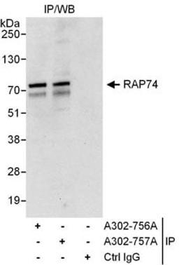 Detection of human RAP74 by western blot of immunoprecipitates.