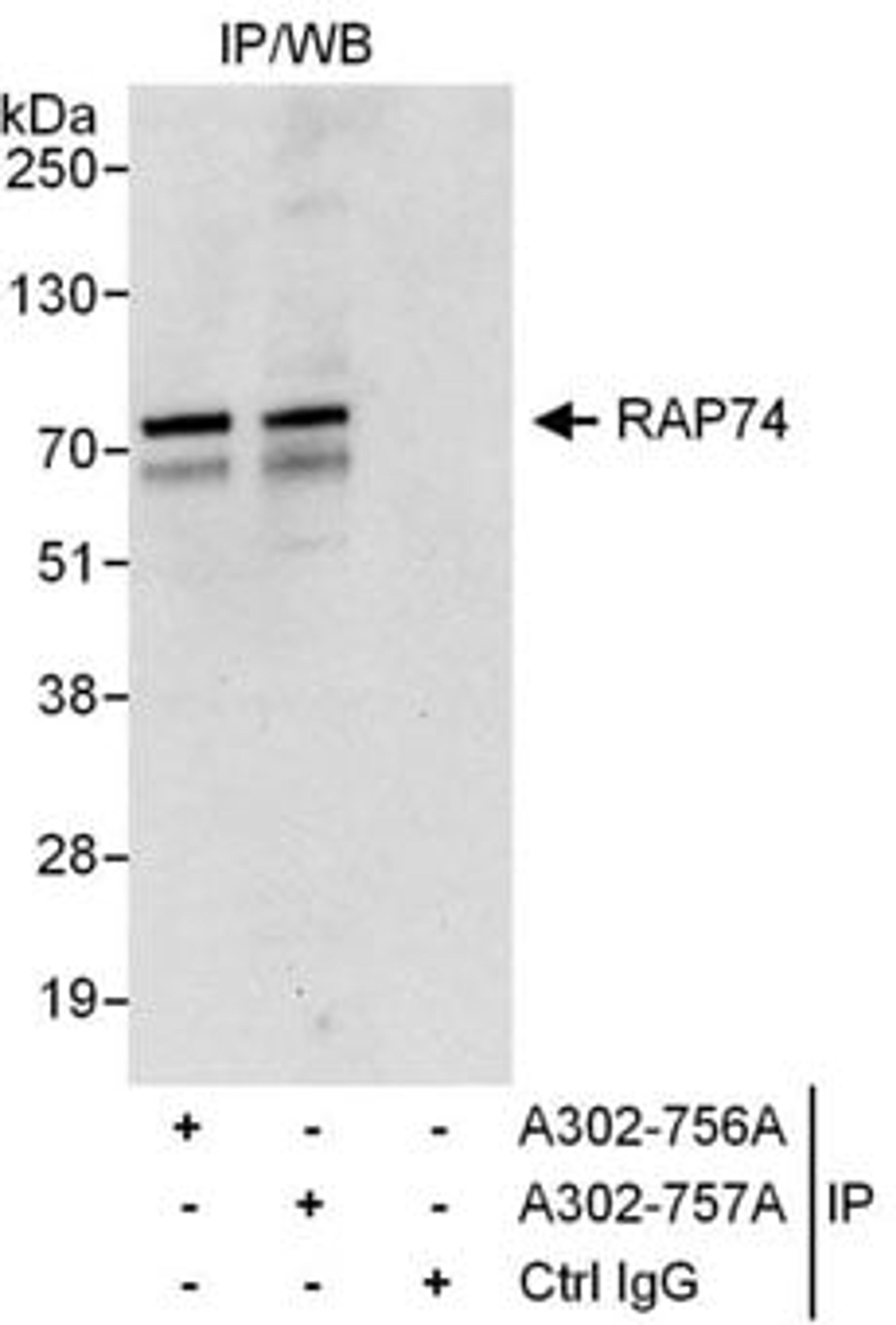 Detection of human RAP74 by western blot of immunoprecipitates.