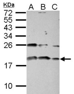 Western Blot: IGF1 Antibody [NBP2-16929] - Sample (30 ug of whole cell lysate) A: PC-3 B: U87-MG C: SK-N-SH 15% SDS PAGE gel, diluted at 1:1000.