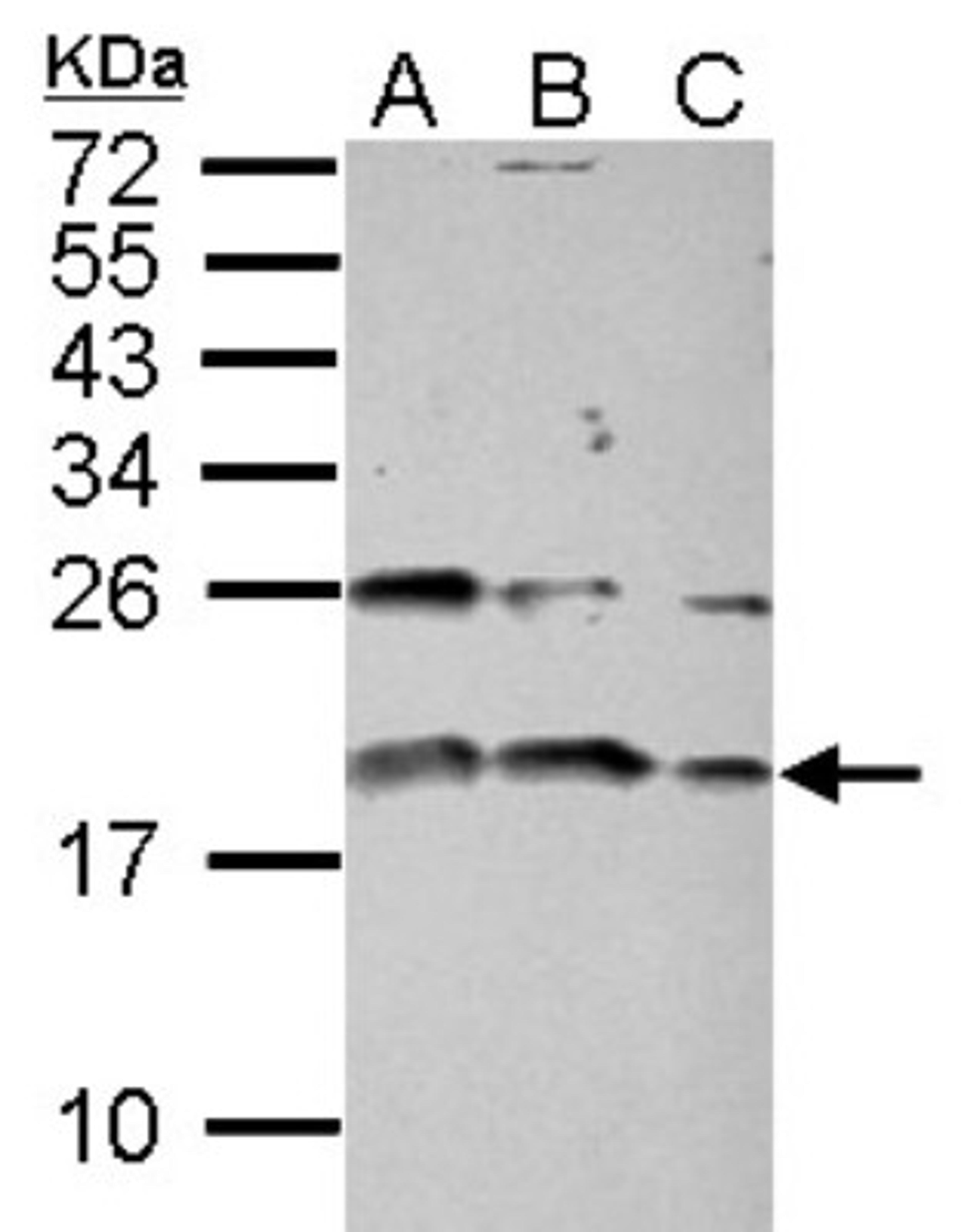 Western Blot: IGF1 Antibody [NBP2-16929] - Sample (30 ug of whole cell lysate) A: PC-3 B: U87-MG C: SK-N-SH 15% SDS PAGE gel, diluted at 1:1000.