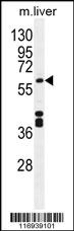 Western blot analysis in mouse liver tissue lysates (35ug/lane).