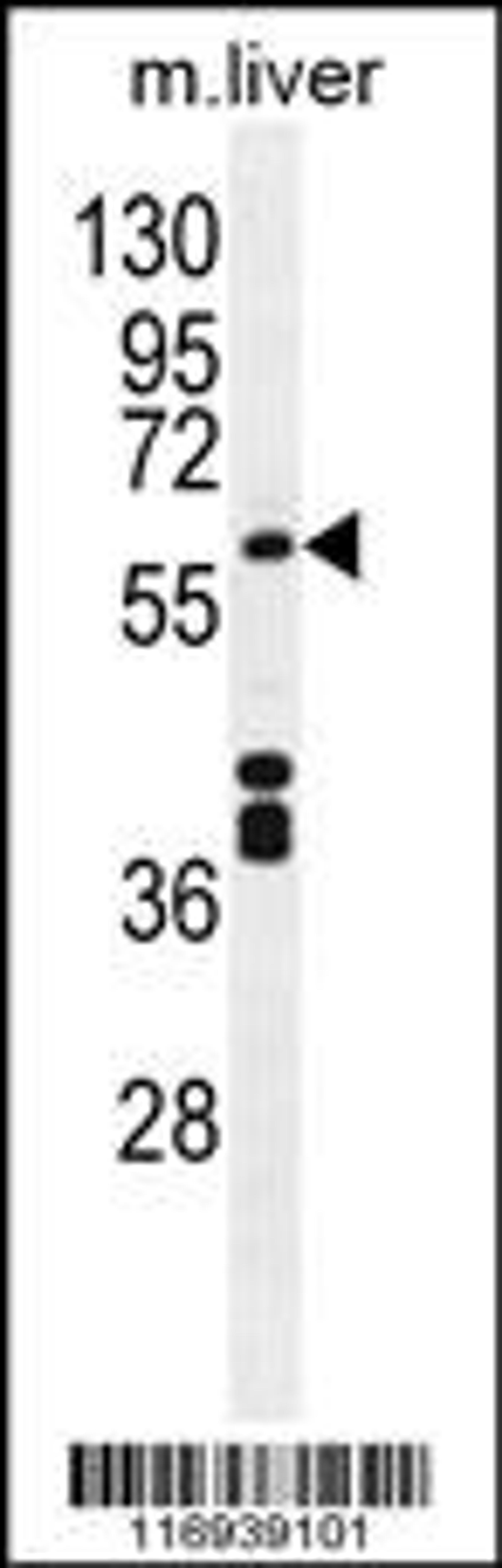 Western blot analysis in mouse liver tissue lysates (35ug/lane).