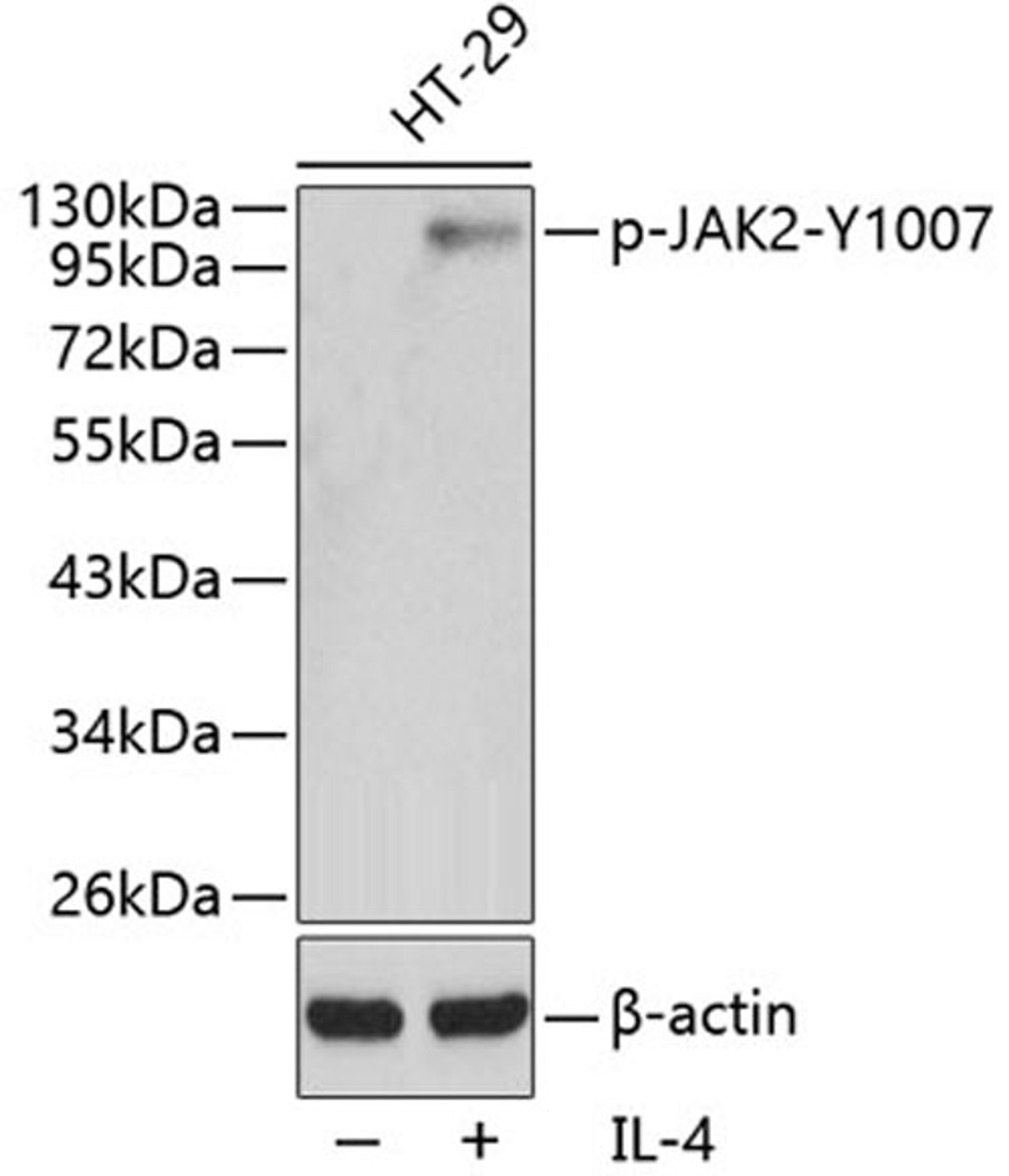 Western blot - Phospho-JAK2-Y1007 antibody (AP0373)