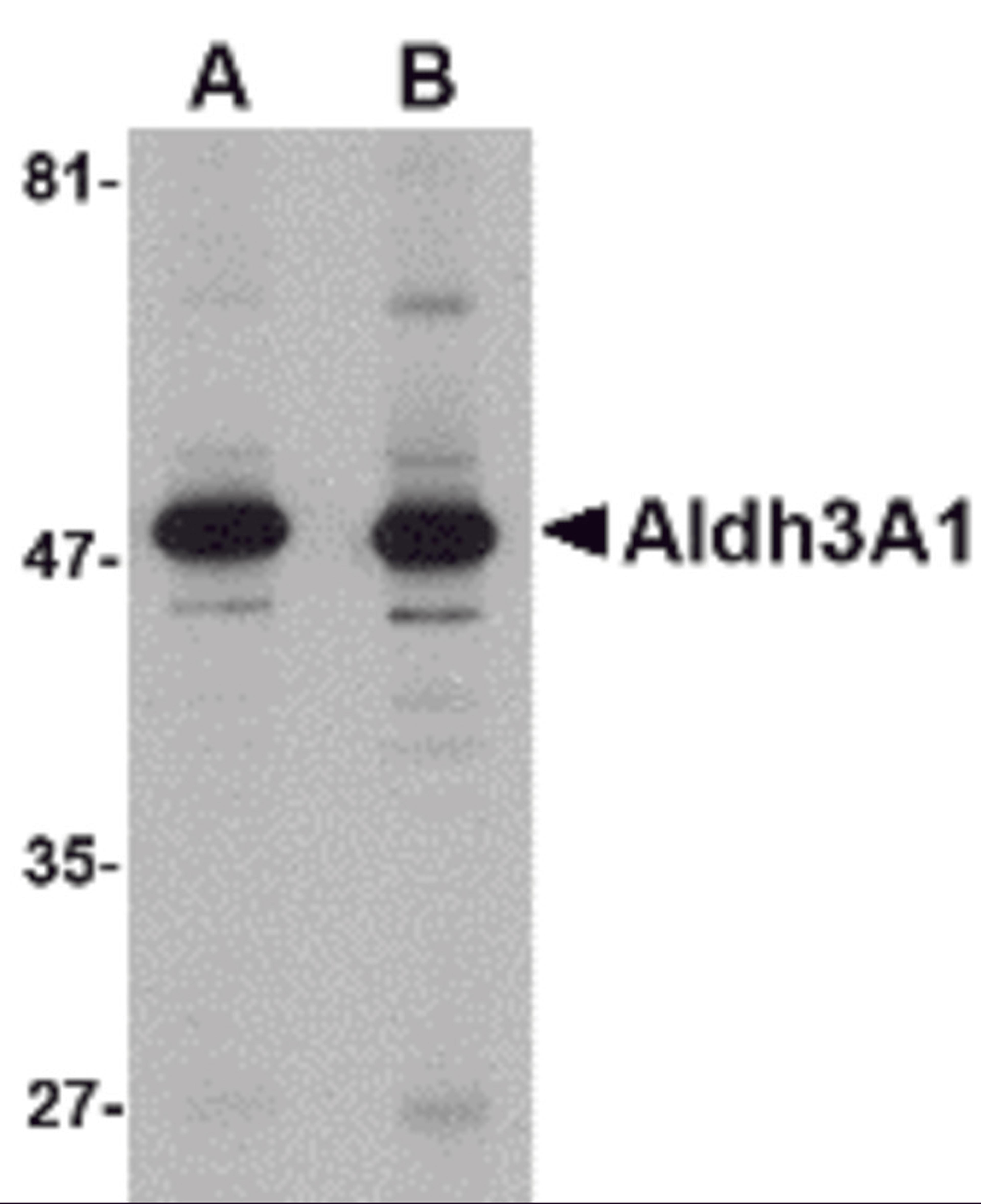 Western blot analysis of Aldh3A1 in human stomach lysate with Aldh3A1 antibody at (A) 1 and (B) 2 &#956;g/mL.