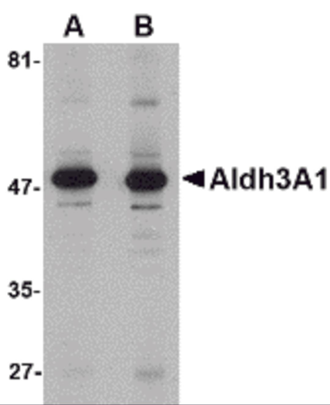 Western blot analysis of Aldh3A1 in human stomach lysate with Aldh3A1 antibody at (A) 1 and (B) 2 μg/mL.