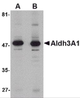 Western blot analysis of Aldh3A1 in human stomach lysate with Aldh3A1 antibody at (A) 1 and (B) 2 μg/mL.