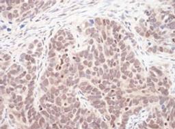 Detection of human MAX by immunohistochemistry.