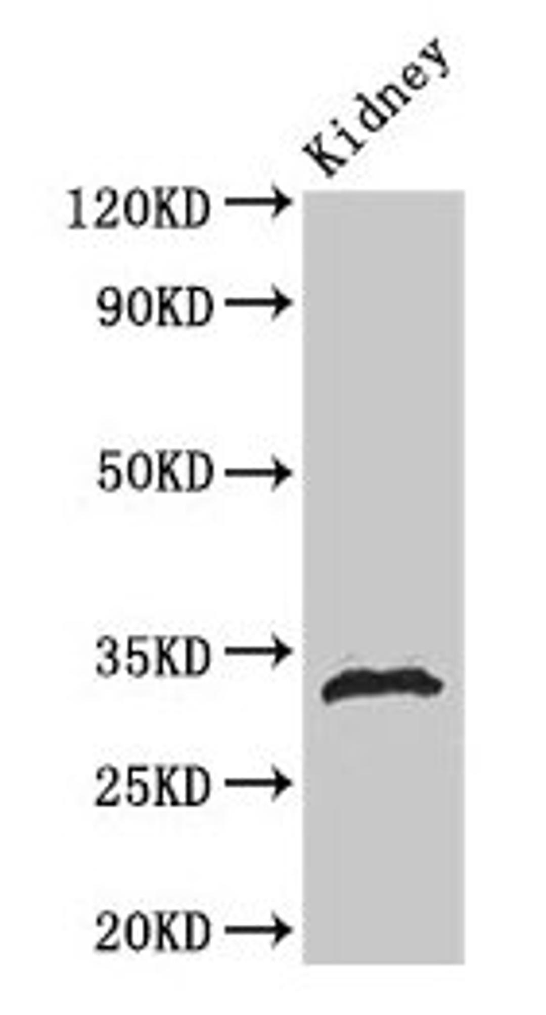 Western Blot. Positive WB detected in: Rat kidney tissue. All lanes: HIST1H1B antibody at 1µg/ml. Secondary. Goat polyclonal to rabbit IgG at 1/50000 dilution. Predicted band size: 23 kDa. Observed band size: 32 kDa
