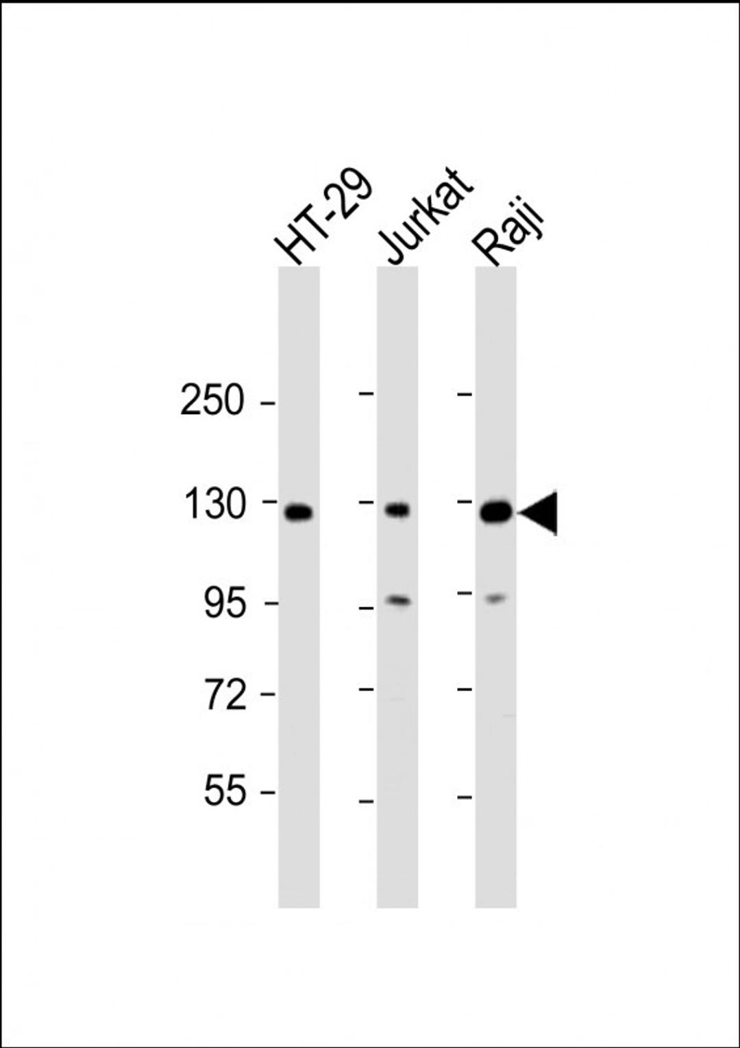 Western Blot at 1:2000 dilution Lane 1: HT-29 whole cell lysate Lane 2: Jurkat whole cell lysate Lane 3: Raji whole cell lysate Lysates/proteins at 20 ug per lane.