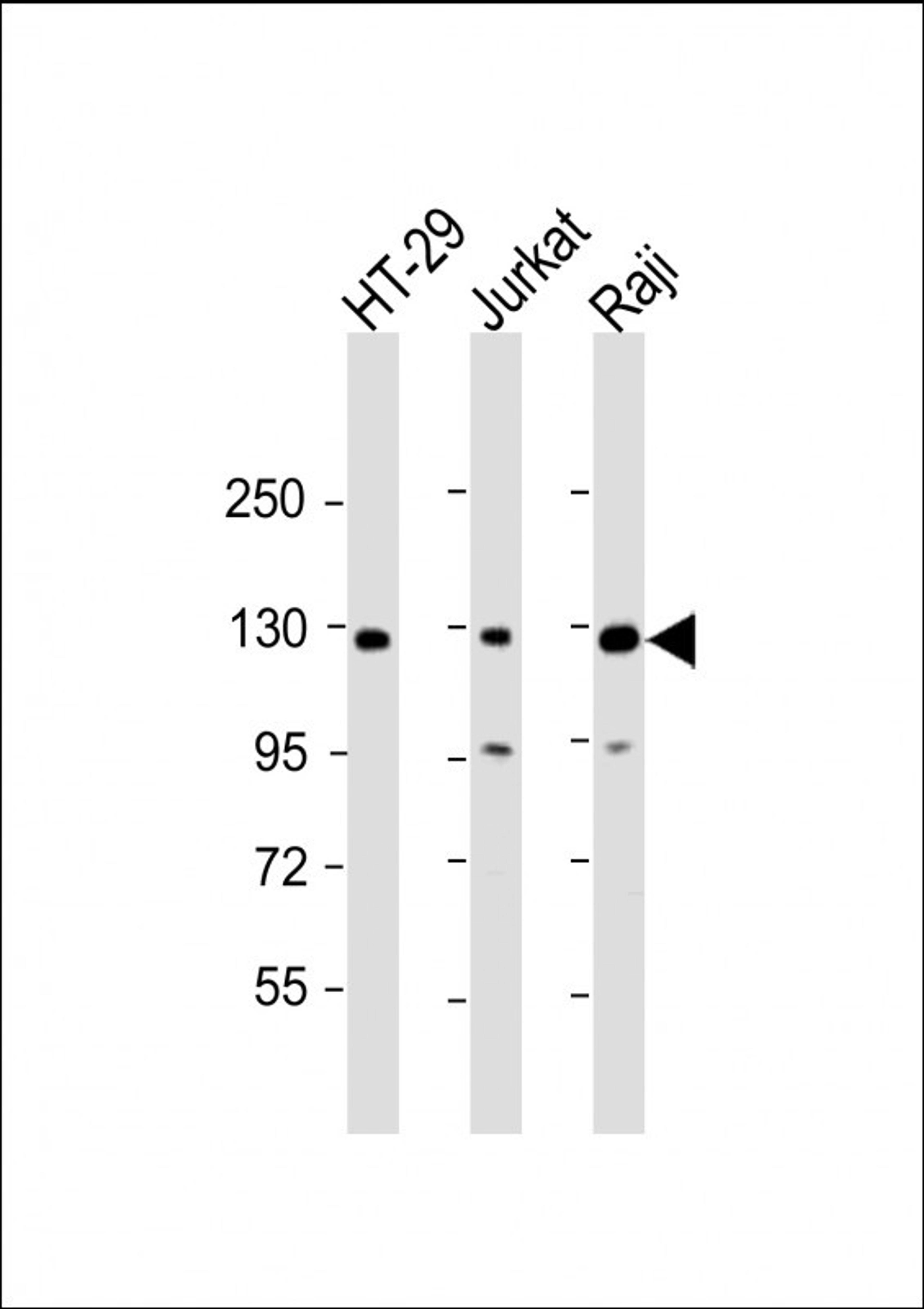 Western Blot at 1:2000 dilution Lane 1: HT-29 whole cell lysate Lane 2: Jurkat whole cell lysate Lane 3: Raji whole cell lysate Lysates/proteins at 20 ug per lane.