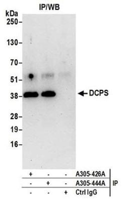 Detection of human DCPS by western blot of immunoprecipitates.