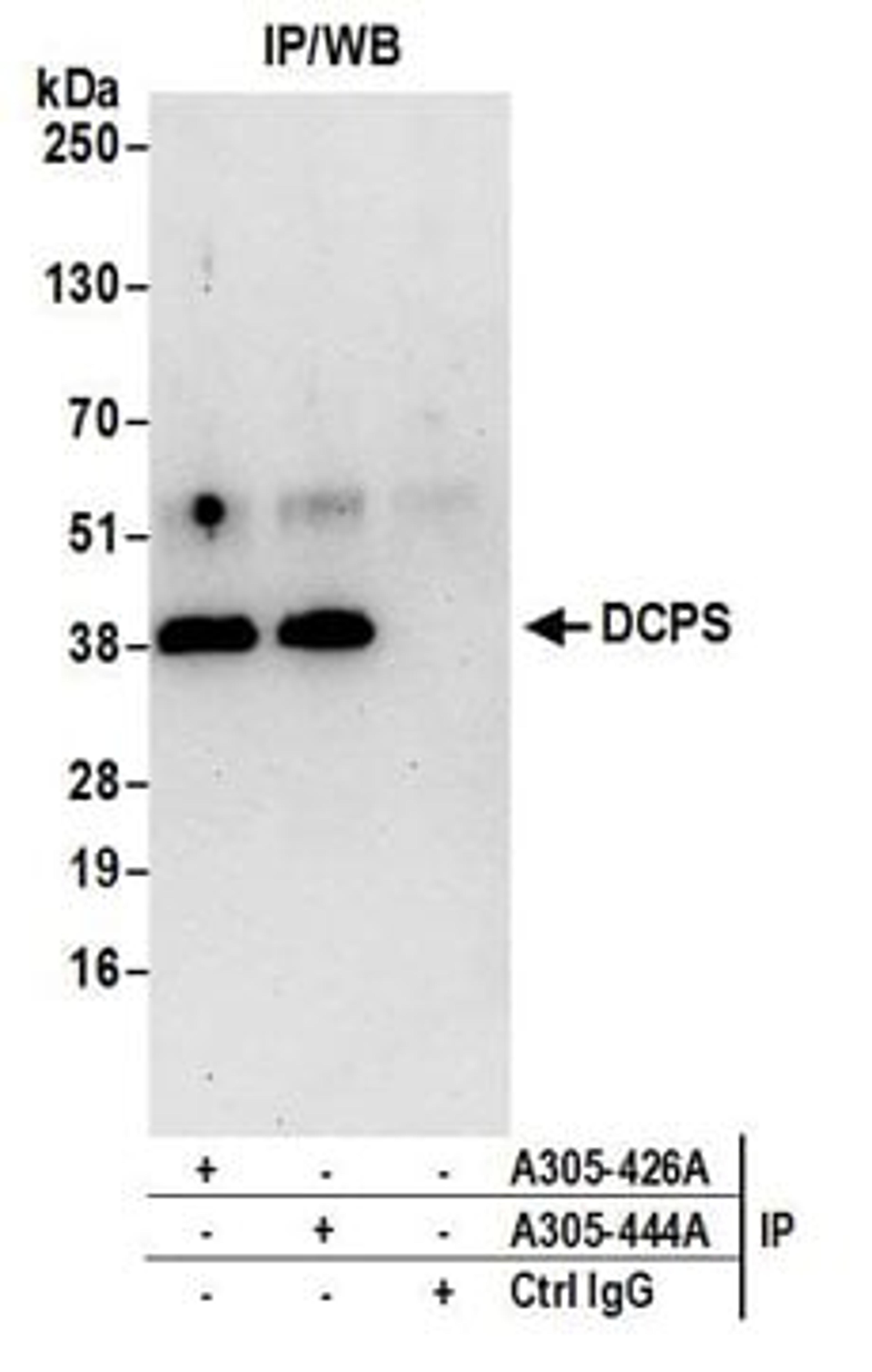 Detection of human DCPS by western blot of immunoprecipitates.