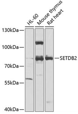 Western blot - SETDB2 antibody (A7391)