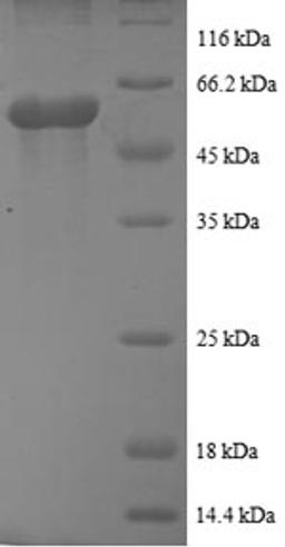 (Tris-Glycine gel) Discontinuous SDS-PAGE (reduced) with 5% enrichment gel and 15% separation gel.