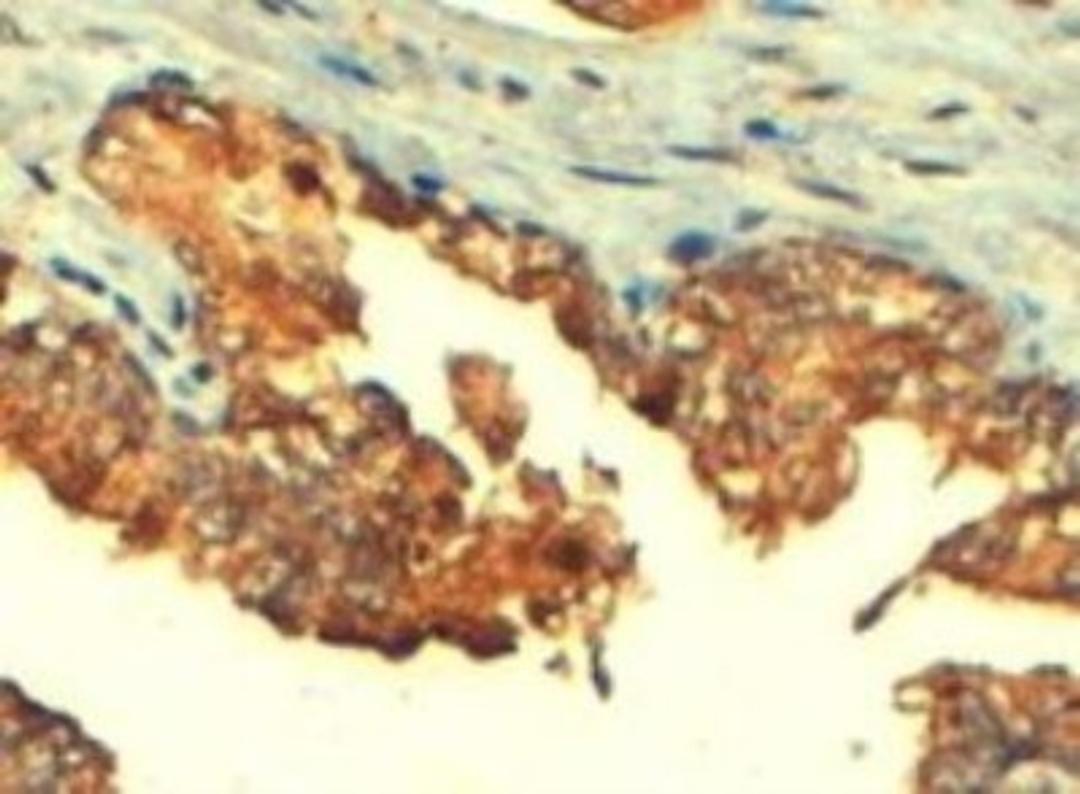 Immunohistochemistry-Paraffin: MRP4 Antibody [NB100-1471] - (4ug/ml) staining of paraffin embedded Human Prostate. Steamed antigen retrieval with citrate buffer pH 6, HRP-staining.