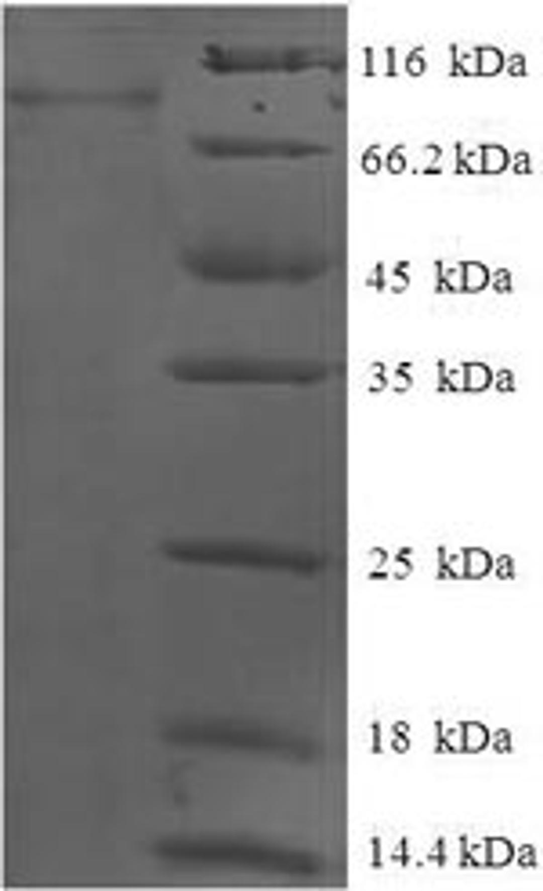 (Tris-Glycine gel) Discontinuous SDS-PAGE (reduced) with 5% enrichment gel and 15% separation gel.