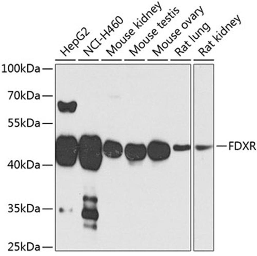 Western blot - FDXR antibody (A3860)