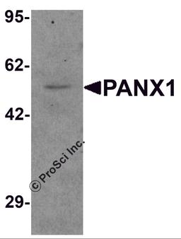 Western blot analysis of PANX1 in human ovary tissue lysate with PANX1 antibody at 1 μg/mL.
