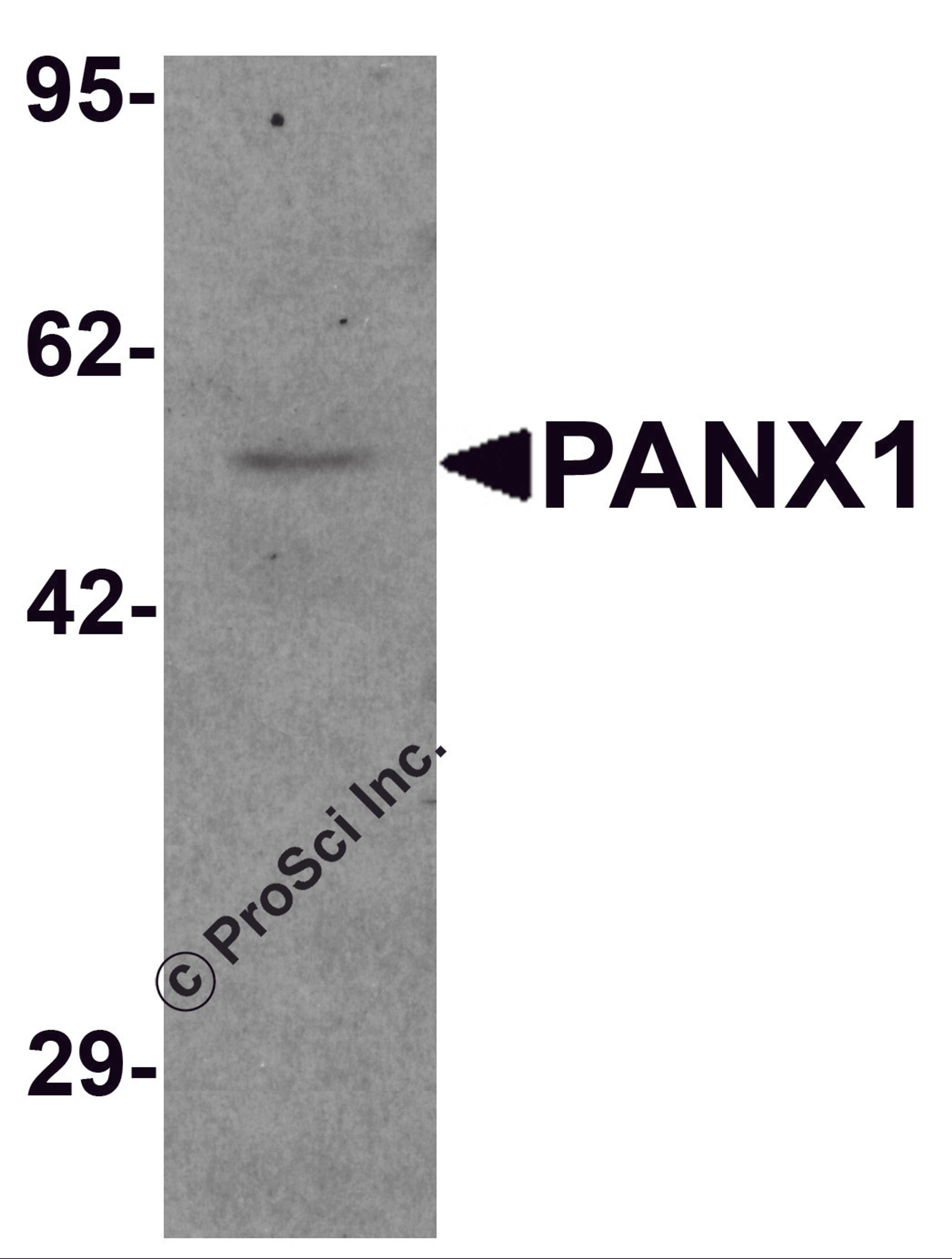 Western blot analysis of PANX1 in human ovary tissue lysate with PANX1 antibody at 1 μg/mL.