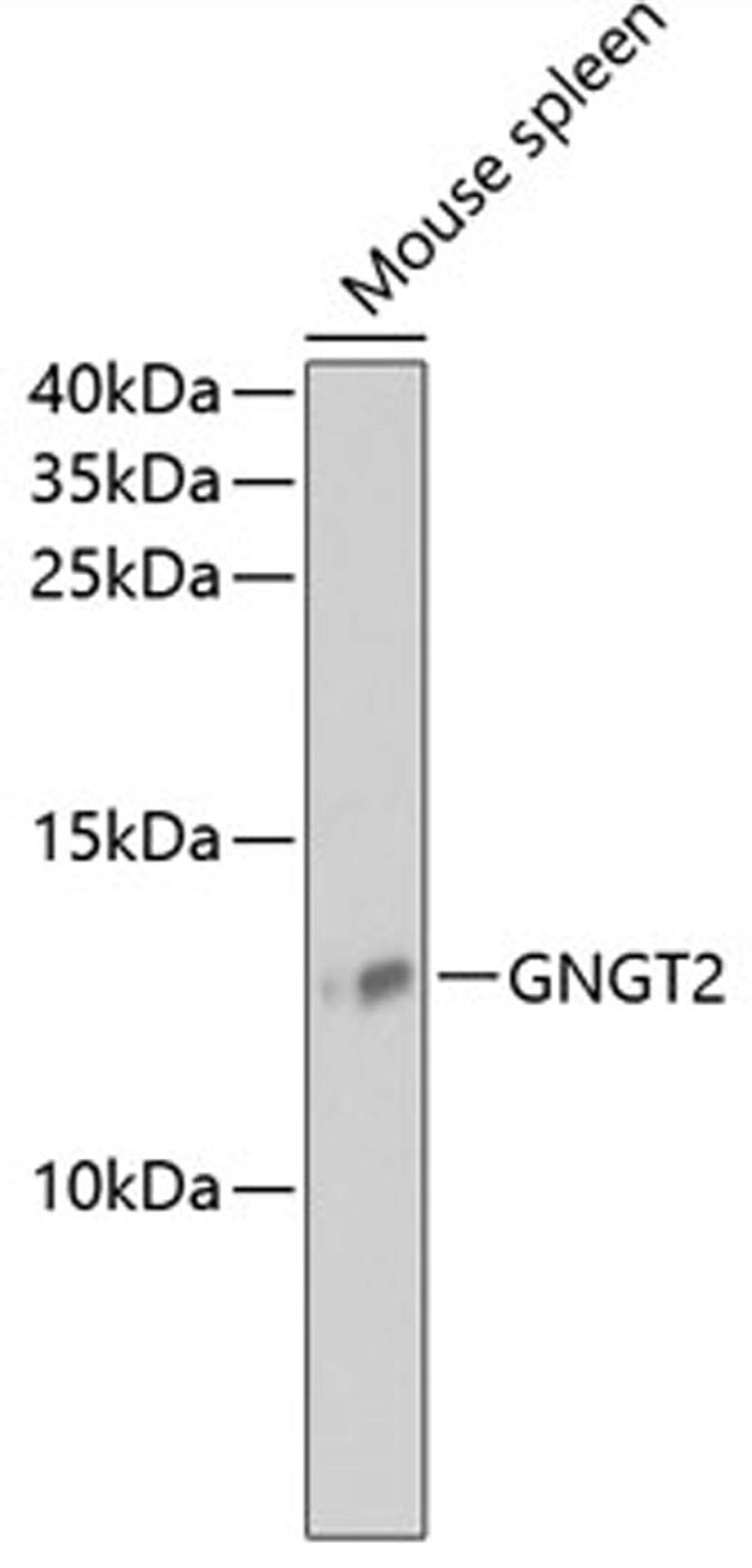 Western blot - GNGT2 antibody (A13992)