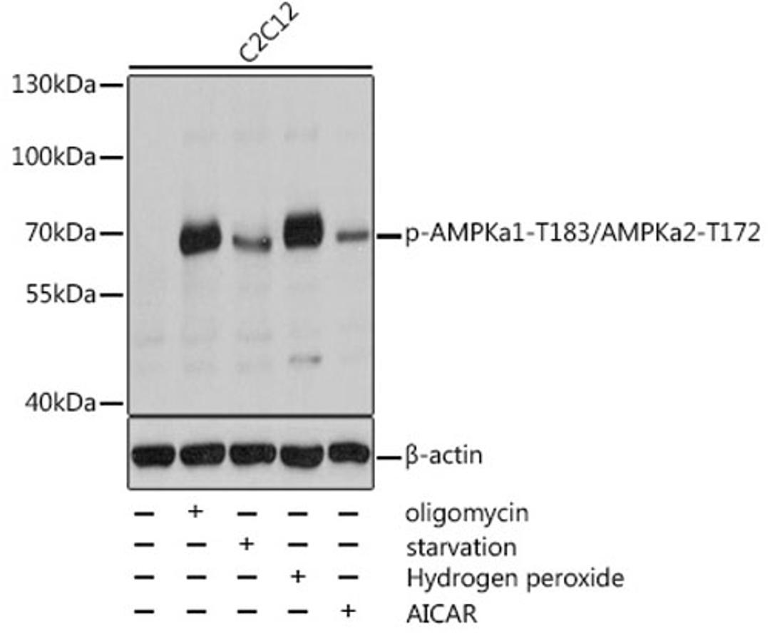 Western blot - Phospho-AMPKa1-T183/AMPKa2-T172 antibody (AP0116)