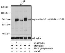 Western blot - Phospho-AMPKa1-T183/AMPKa2-T172 antibody (AP0116)