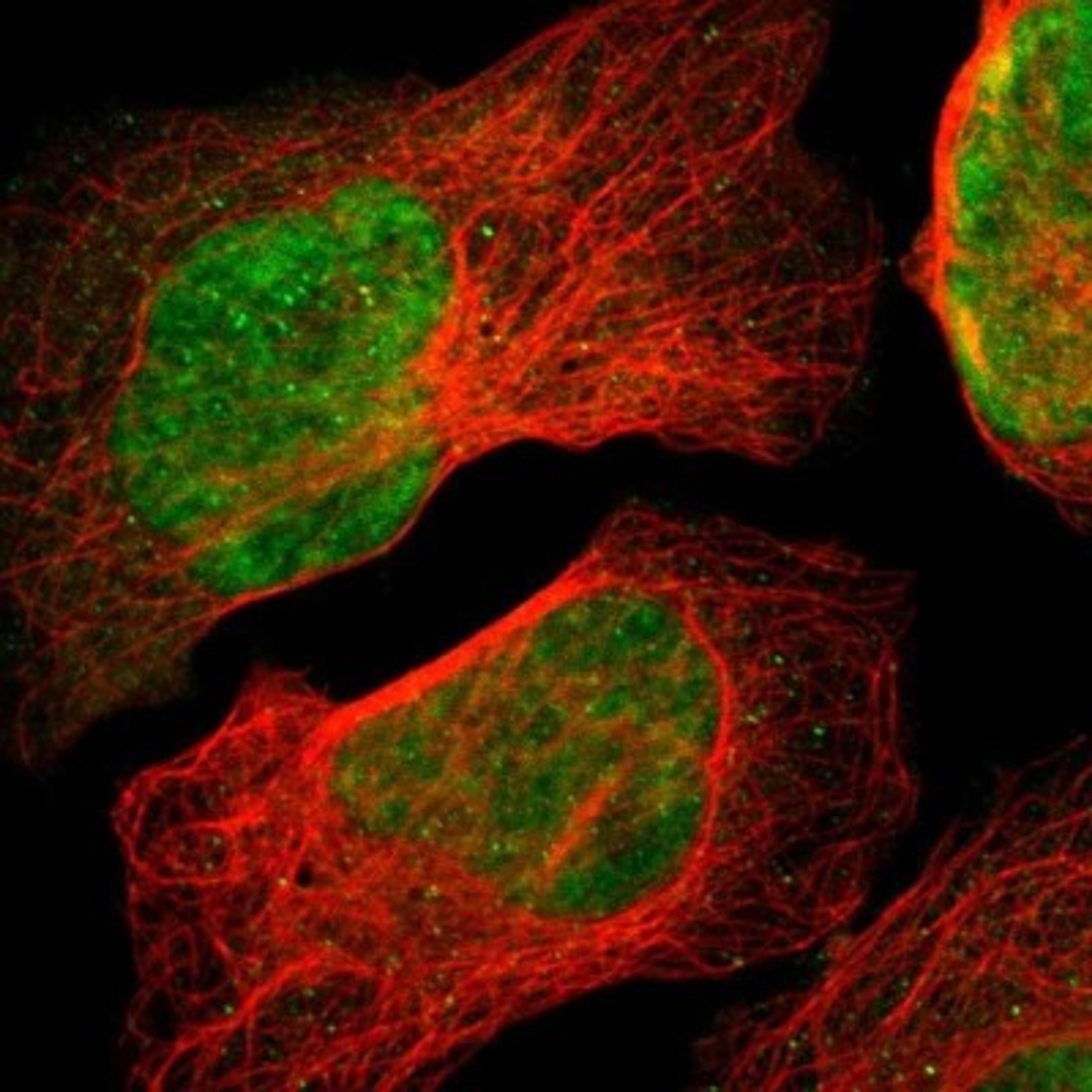 Immunocytochemistry/Immunofluorescence: ZNF446 Antibody [NBP1-80593] - Staining of human cell line U-2 OS shows positivity in nucleus but not nucleoli.