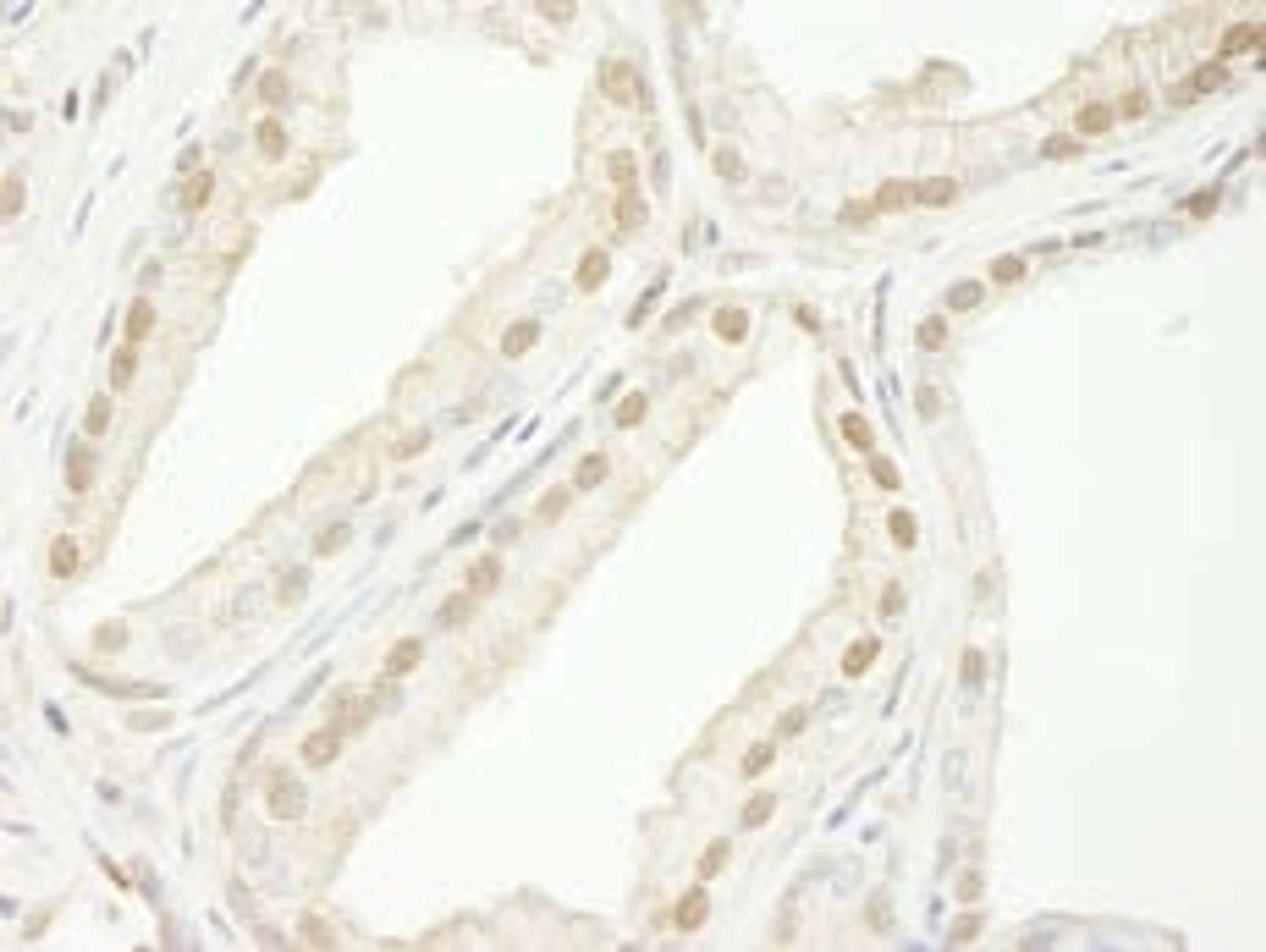 Detection of human TRIM33/TIF1gamma by immunohistochemistry.