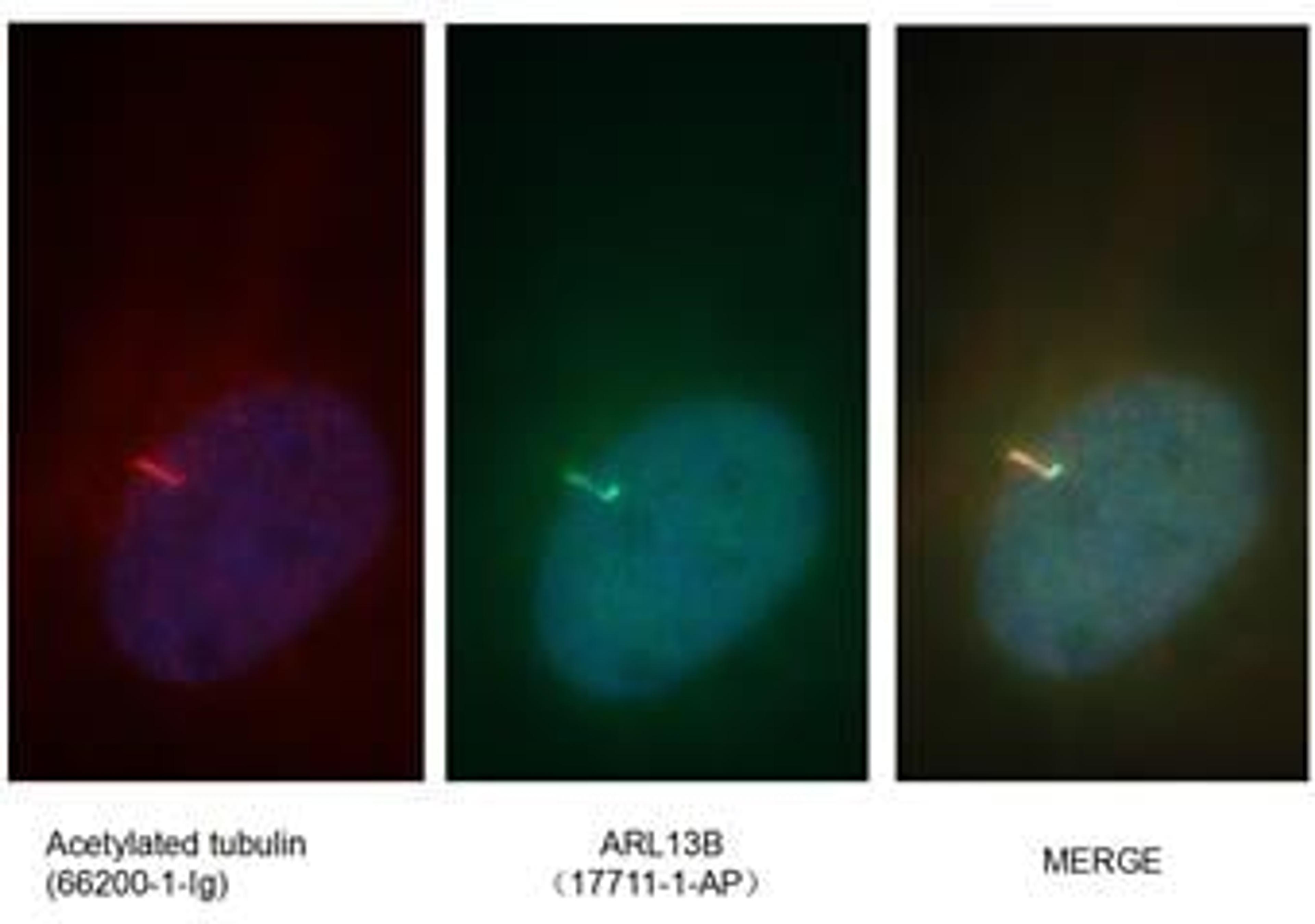 Immunofluorescent analysis of ( 4% PFA ) fixed MDCK cells using 17711-1-AP(ARL13B antibody) at dilution of 1:100 and Alexa Fluor 488-conjugated AffiniPure Goat Anti-Rabbit IgG(H+L)