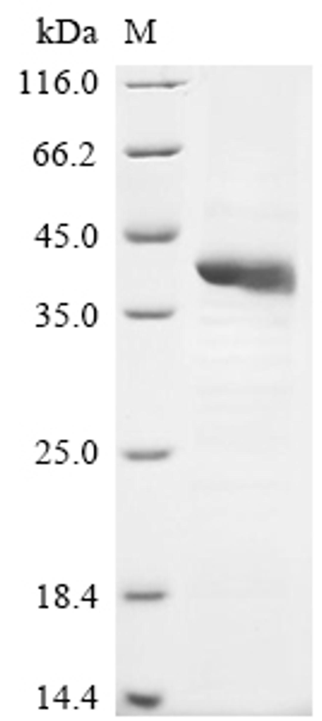 (Tris-Glycine gel) Discontinuous SDS-PAGE (reduced) with 5% enrichment gel and 15% separation gel.