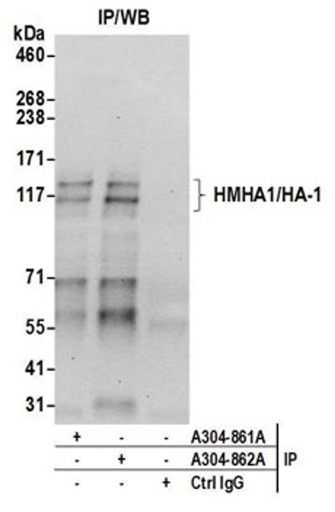 Detection of human HMHA1/HA-1 by western blot of immunoprecipitates.