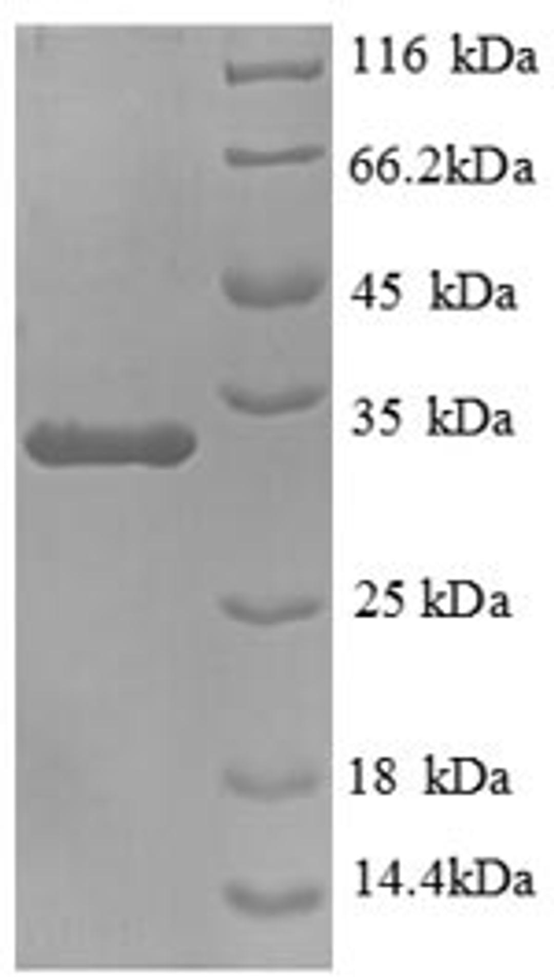 (Tris-Glycine gel) Discontinuous SDS-PAGE (reduced) with 5% enrichment gel and 15% separation gel.