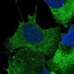 Immunocytochemistry: CBFB Antibody [NBP1-87300] - Immunofluorescence: Immunofluorescent staining of human cell line U-2 OS shows positivity in cytoplasm.