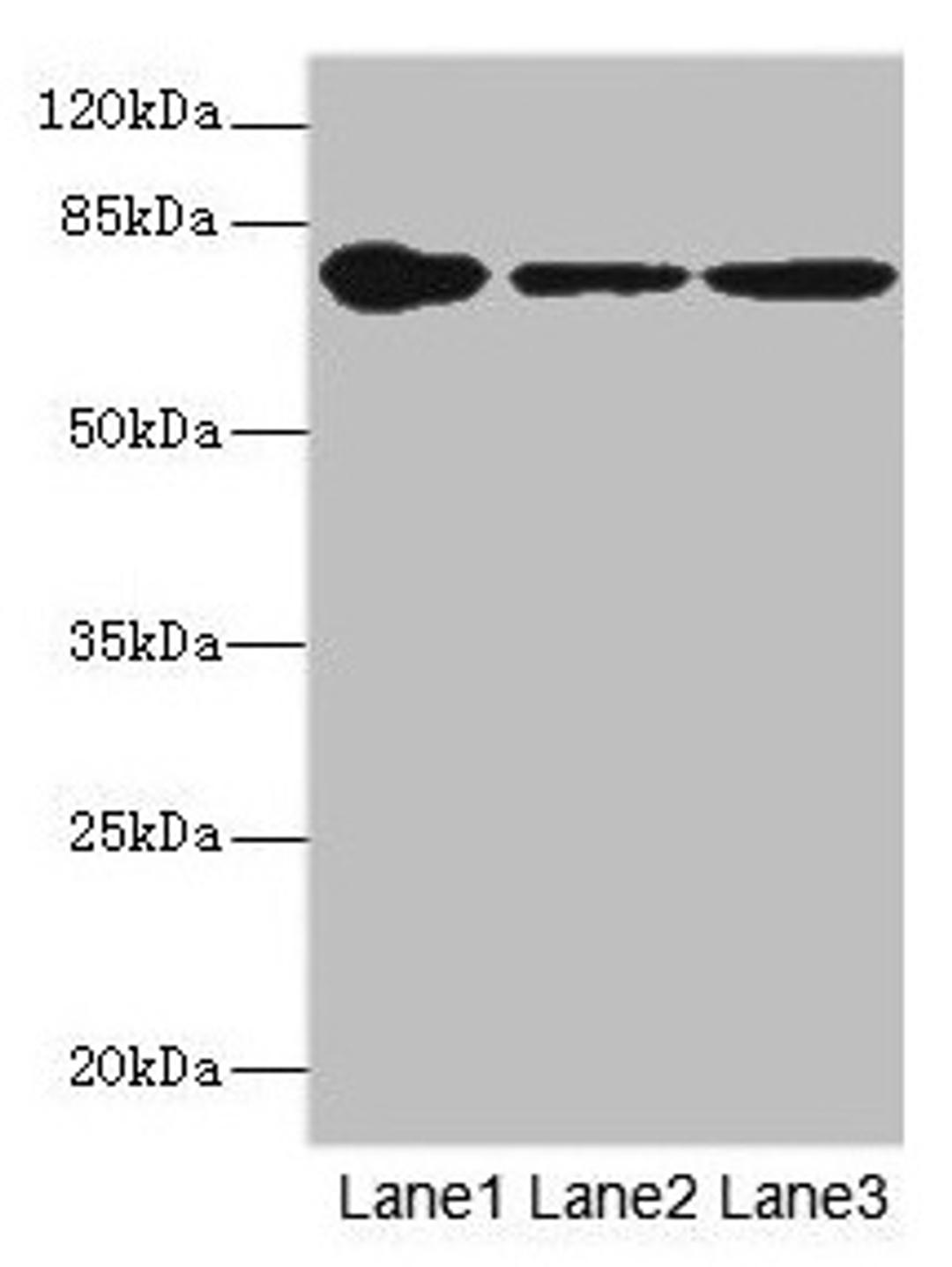 Western blot. All lanes: FZD3 antibody at 1.94µg/ml. Lane 1: THP-1 whole cell lysate. Lane 2: Hela whole cell lysate. Lane 3: HepG2 whole cell lysate. Secondary. Goat polyclonal to rabbit IgG at 1/10000 dilution. Predicted band size: 77 kDa. Observed band size: 77 kDa