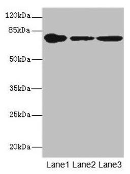 Western blot. All lanes: FZD3 antibody at 1.94µg/ml. Lane 1: THP-1 whole cell lysate. Lane 2: Hela whole cell lysate. Lane 3: HepG2 whole cell lysate. Secondary. Goat polyclonal to rabbit IgG at 1/10000 dilution. Predicted band size: 77 kDa. Observed band size: 77 kDa