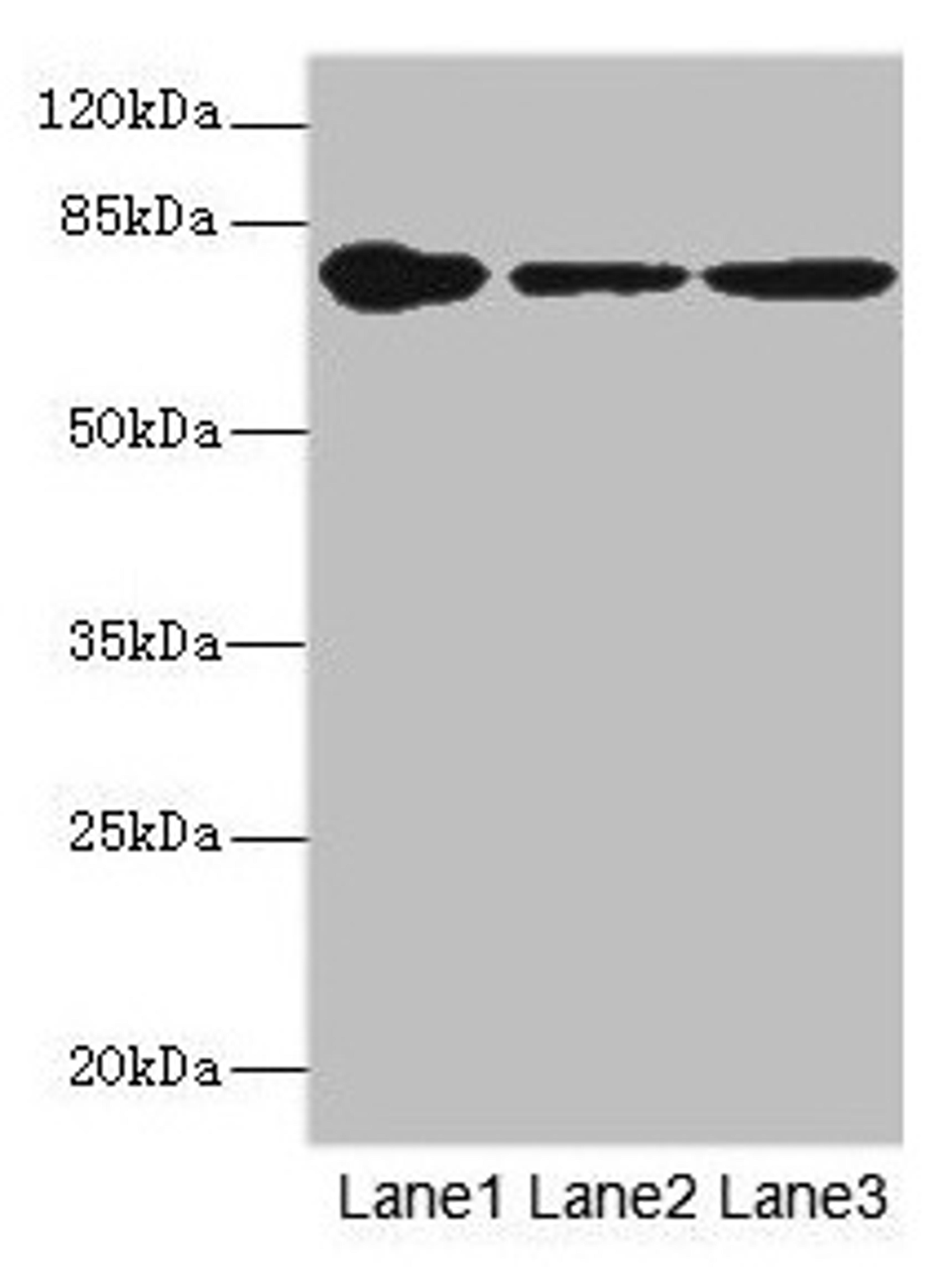 Western blot. All lanes: FZD3 antibody at 1.94µg/ml. Lane 1: THP-1 whole cell lysate. Lane 2: Hela whole cell lysate. Lane 3: HepG2 whole cell lysate. Secondary. Goat polyclonal to rabbit IgG at 1/10000 dilution. Predicted band size: 77 kDa. Observed band size: 77 kDa