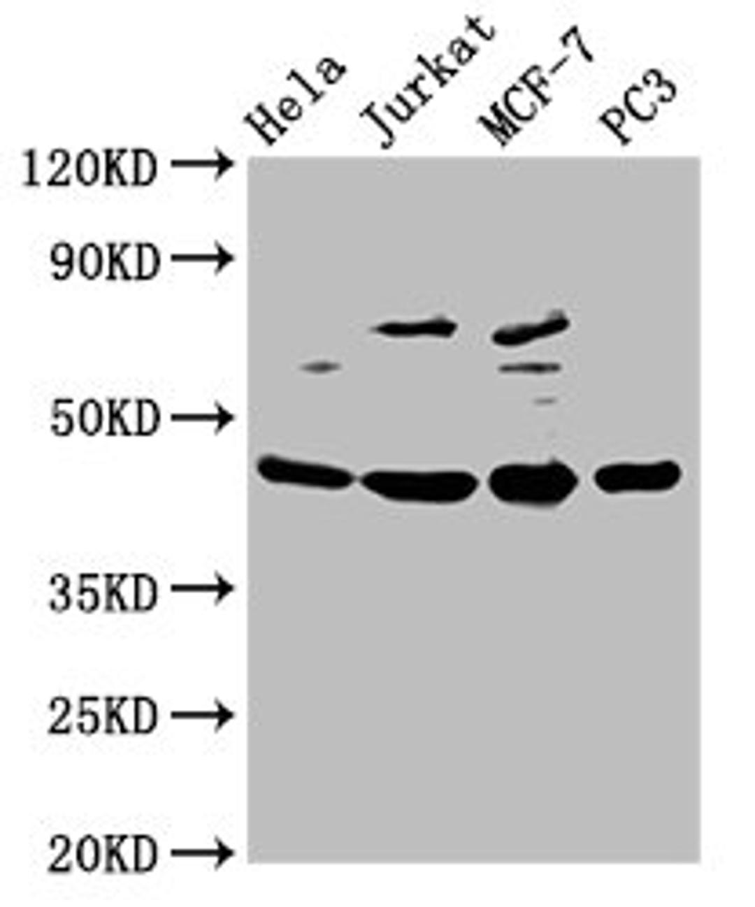 Western Blot. Positive WB detected in: Hela whole cell lysate, Jurkat whole cell lysate, MCF-7 whole cell lysate, PC-3 whole cell lysate. All lanes: PA2G4 antibody at 2.5ug/ml. Secondary. Goat polyclonal to rabbit IgG at 1/50000 dilution. Predicted band size: 44, 39 kDa. Observed band size: 44 kDa. 