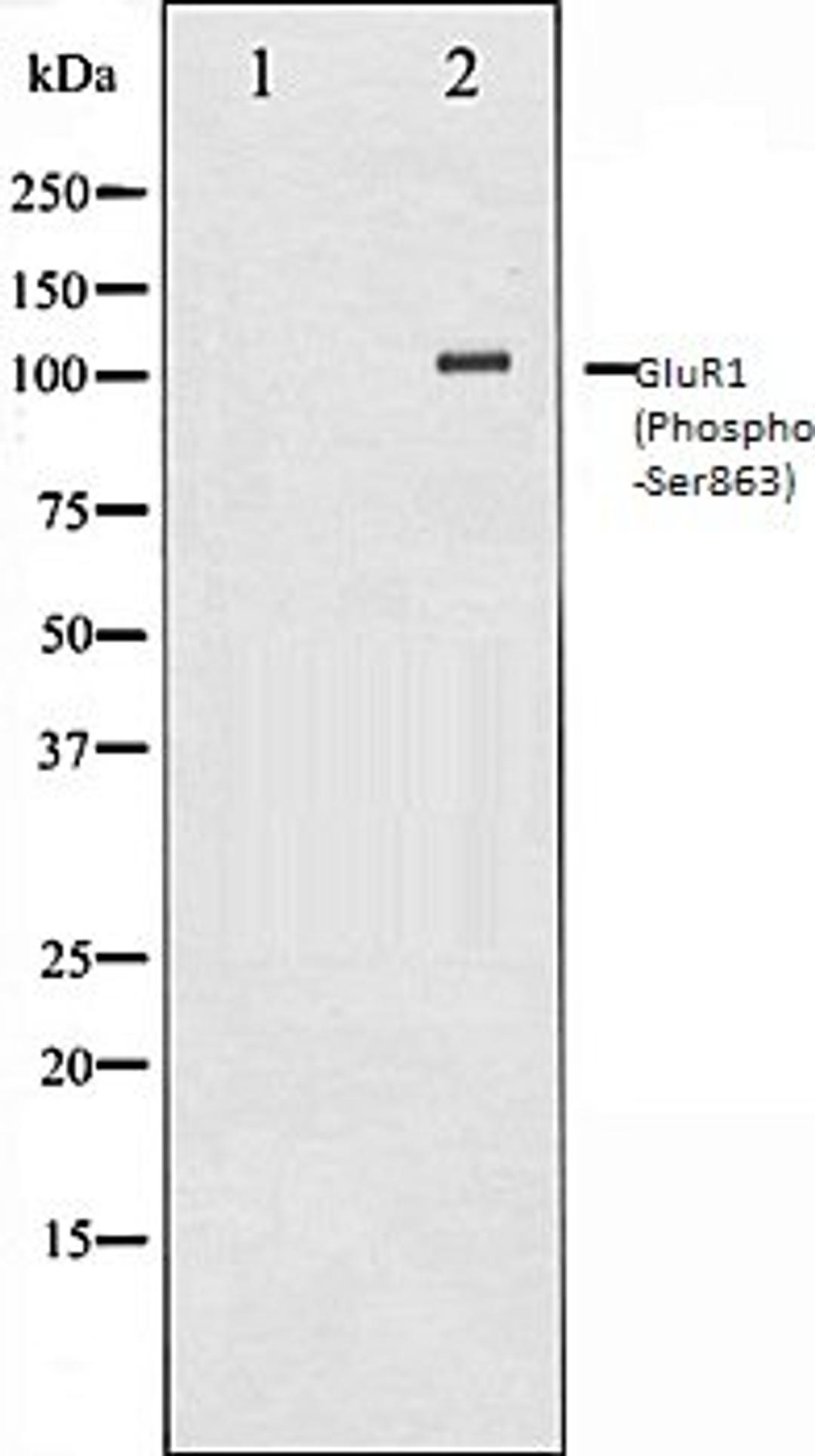 Western blot analysis of HeLa whole cell lysates using GluR1 (Phospho-Ser863) antibody, The lane on the left is treated with the antigen-specific peptide.