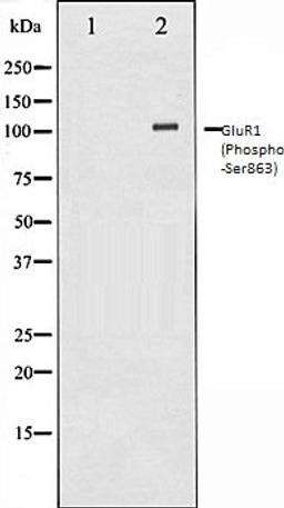 Western blot analysis of HeLa whole cell lysates using GluR1 (Phospho-Ser863) antibody, The lane on the left is treated with the antigen-specific peptide.