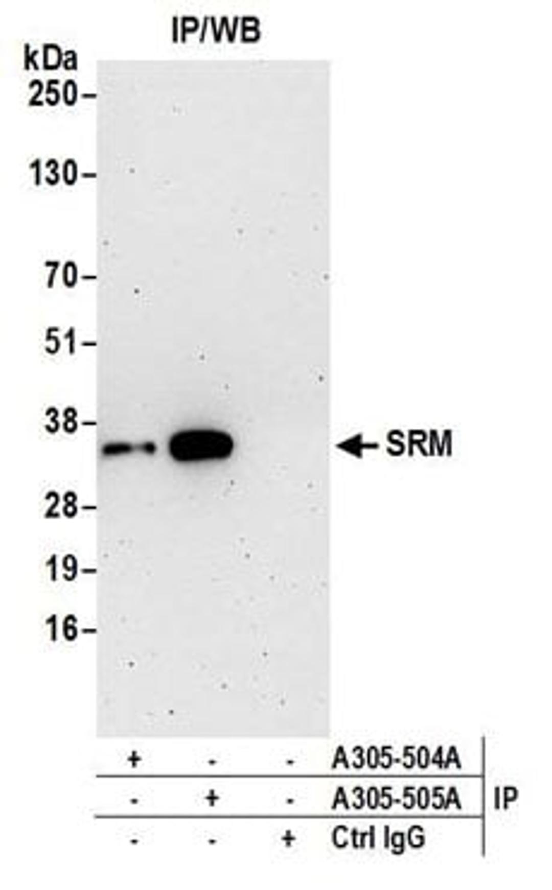 Detection of human SRM by western blot of immunoprecipitates.