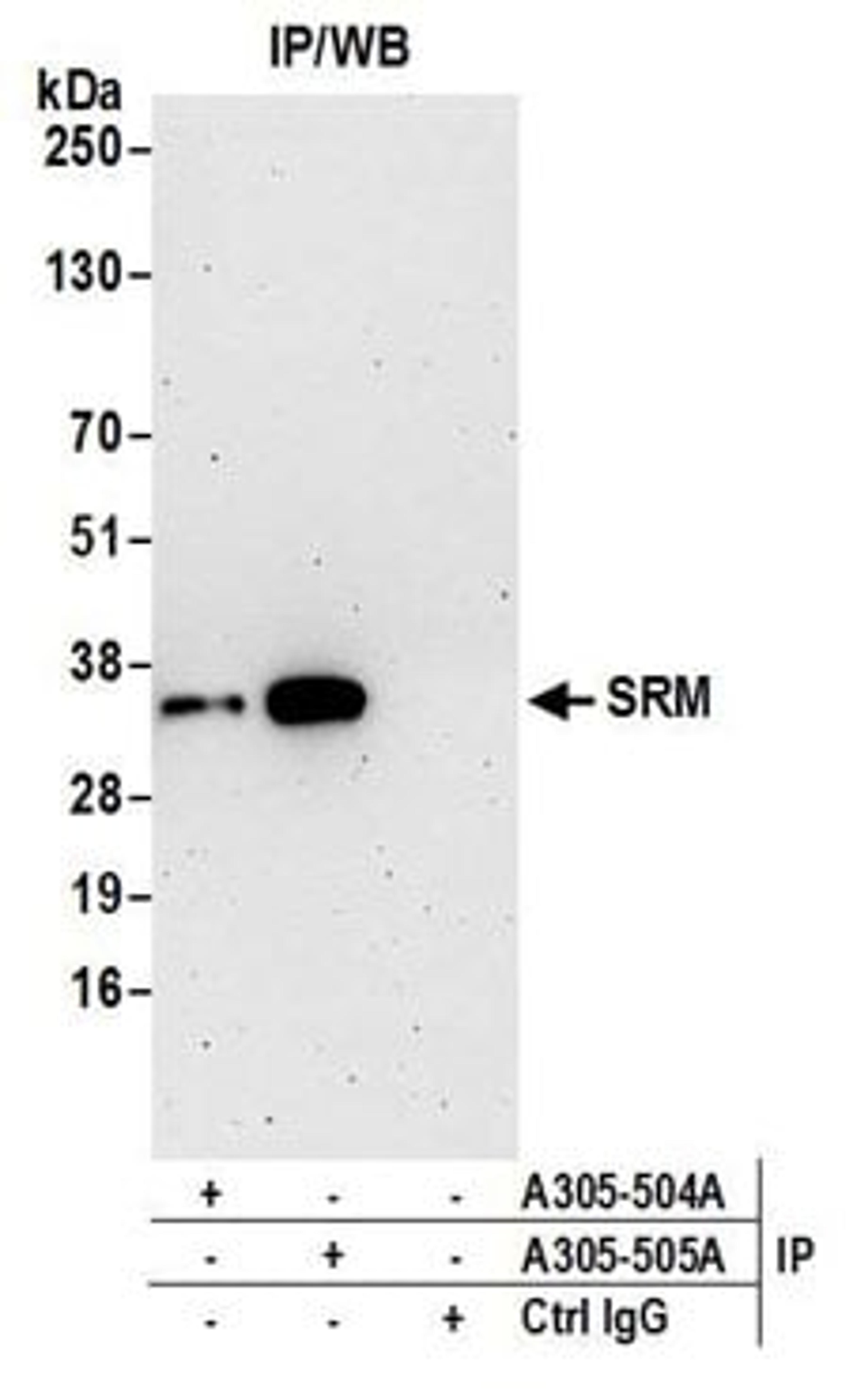 Detection of human SRM by western blot of immunoprecipitates.