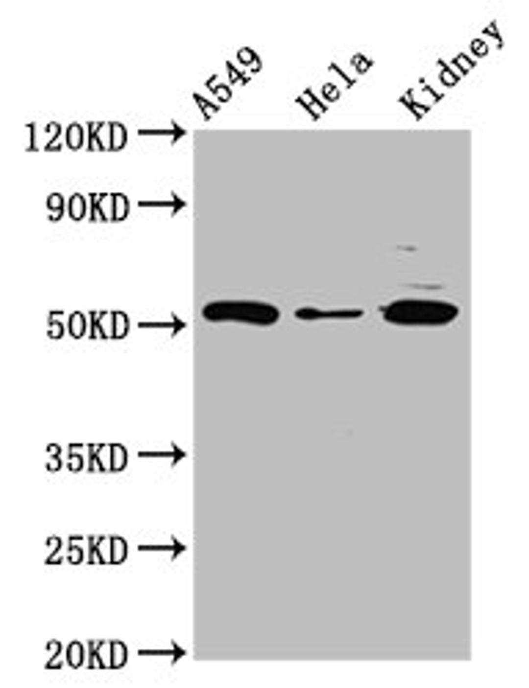 Western Blot. Positive WB detected in: A549 whole cell lysate, Hela whole cell lysate, Rat kidney tissue. All lanes: FICD antibody at 3µg/ml. Secondary. Goat polyclonal to rabbit IgG at 1/50000 dilution. Predicted band size: 52 kDa. Observed band size: 52 kDa