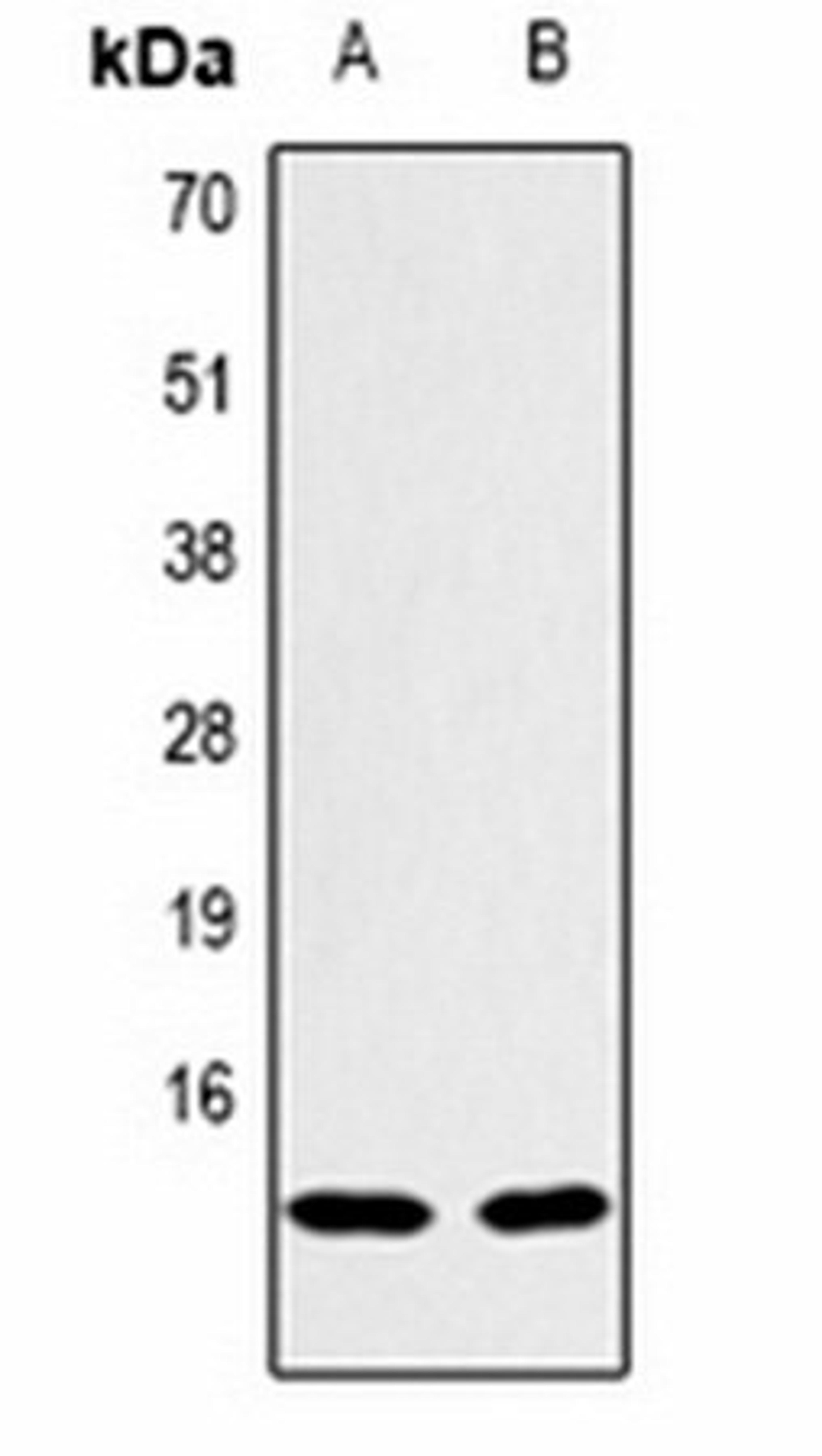 Western blot analysis of Hela (Lane1), NIH3T3 (Lane2) whole cell lysates using Histone H2B (TriMethyl K43) antibody