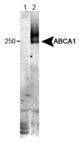 Western Blot: ABCA1 Antibody (HJ1) [NB100-2068] - Detection of ABCA1 in wildtype liver tissue (in RIPA) Lane 1: KO mouse liver tissue. Lane 2: WT mouse liver tissue.