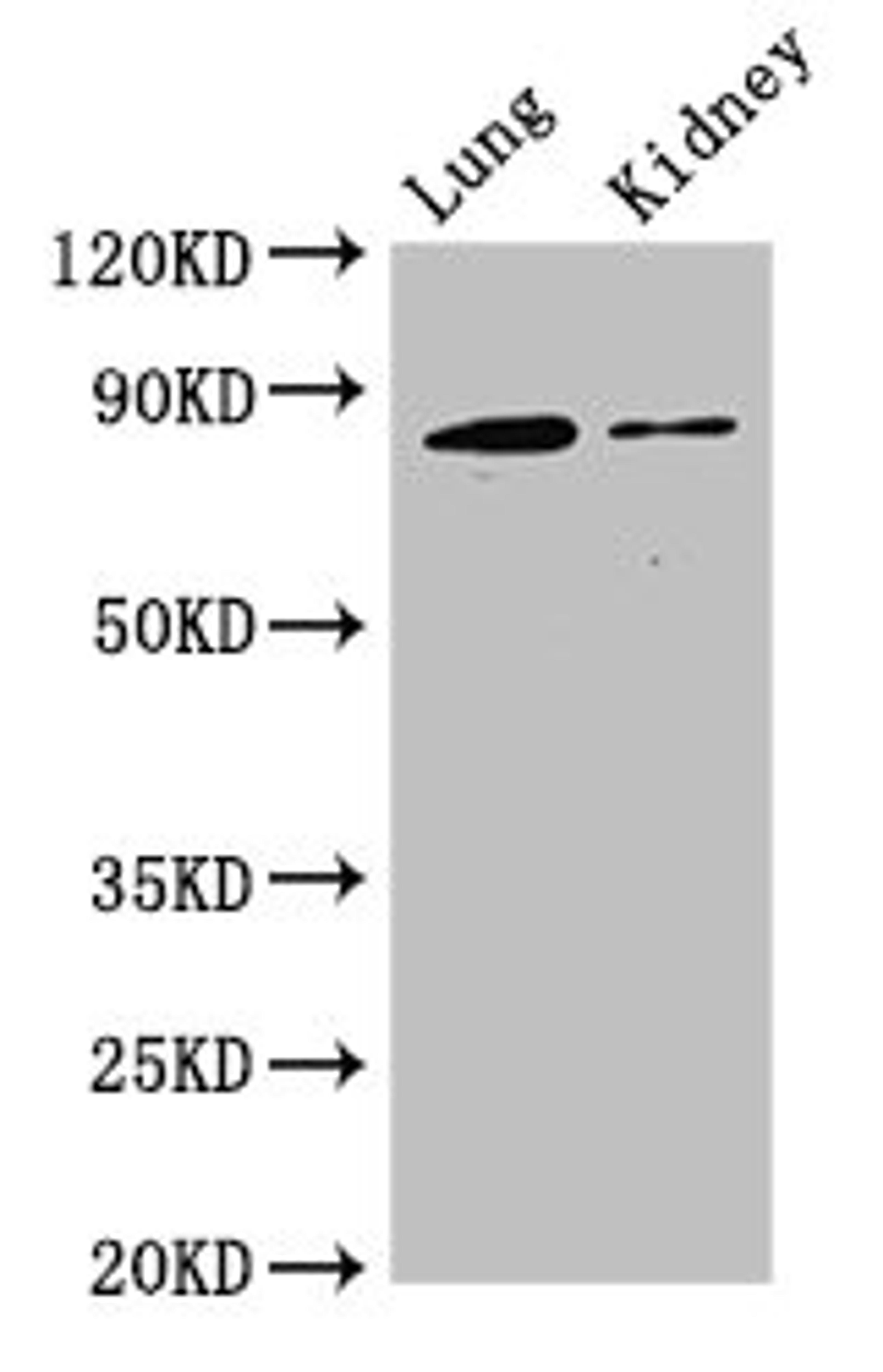 Western Blot. Positive WB detected in: Mouse lung tissue, Mouse kidney tissue. All lanes: CDH5 antibody at 3ug/ml. Secondary. Goat polyclonal to rabbit IgG at 1/50000 dilution. Predicted band size: 88, 75 kDa. Observed band size: 88 kDa.