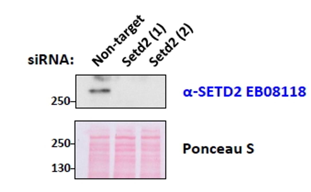 45-757 (0.5ug/ml) staining of mouse fibroblast lysates transiently expressing different siRNA in second and third lane (35ug protein in RIPA buffer). Primary incubation was 1 hour. Detected by chemiluminescence.