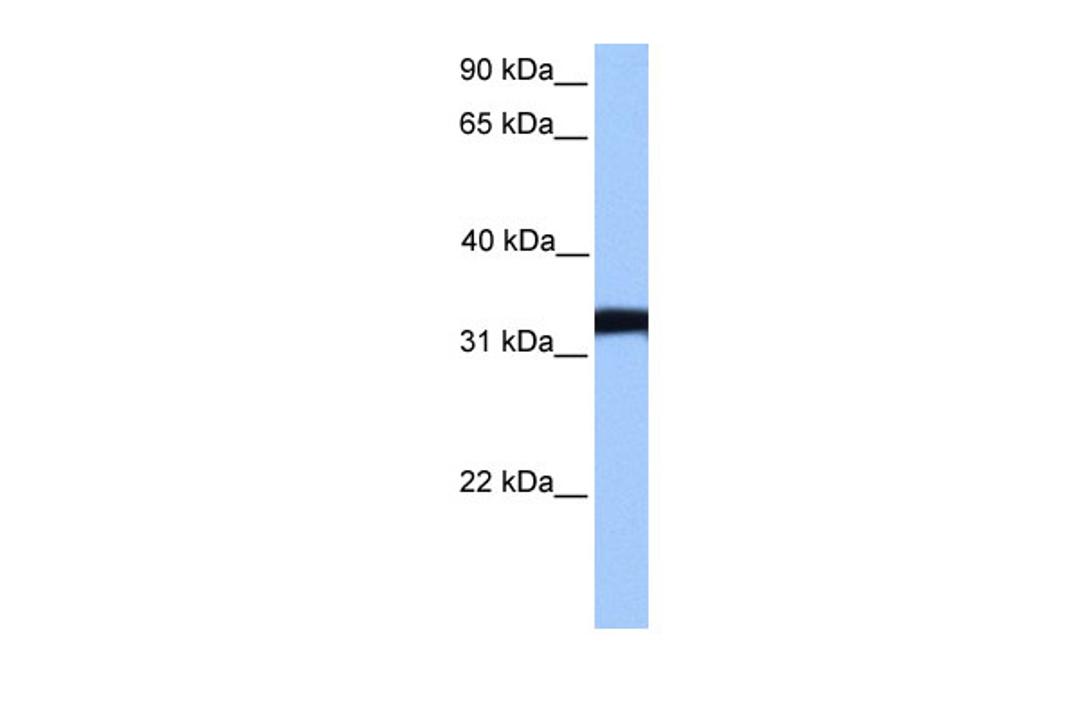 Antibody used in WB on Human NTERA2 at 0.2-1 ug/ml.